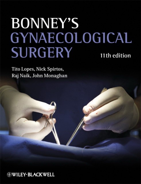 Lopes Bonneys Gynaecological Surgery 