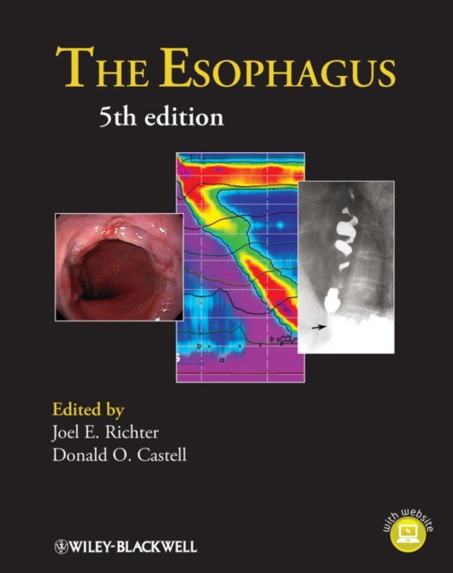 Richter The Esophagus, 5th Edition 