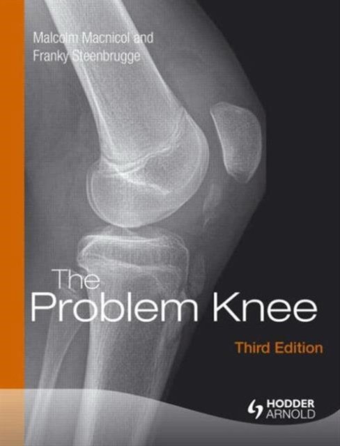 Malcolm Macnicol, Franky Steenbrugge The Problem Knee, Third Edition 