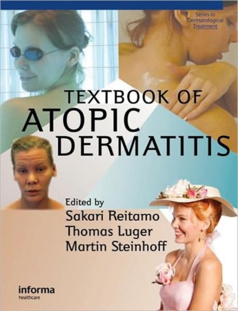 Reitamo Textbook Atopic Dermatitis 