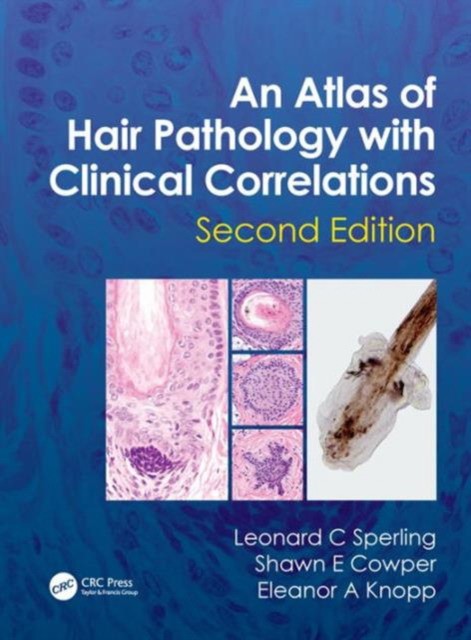 Leonard C. Sperling An Atlas of Hair Pathology with Clinical Correlations, 2 Ed. 