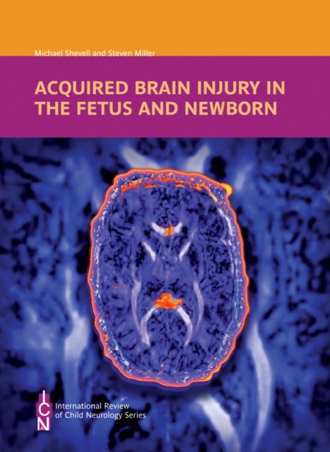 Shevell Michael Acquired Brain Injury in the Fetus and Newborn 