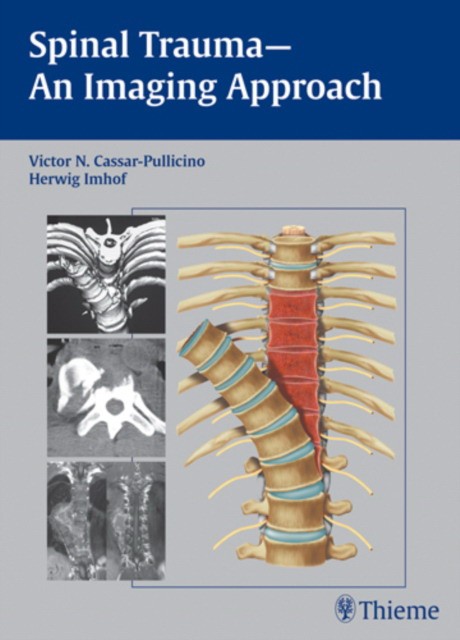 Victor N. Cassar-Pullicino Spinal Trauma - An Imaging Approach 