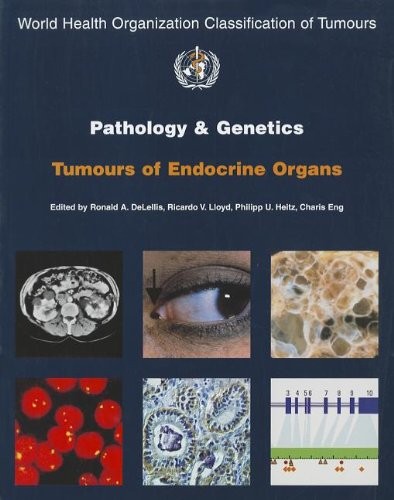 DeLellis WHO Classification of Tumours Pathology & Genetics of Tumours of Endocrine Organs. 