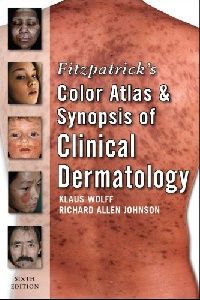 Johnson Fitzpatrick's Color Atlas and Synopsis of Clinical Dermatology (     ) 