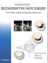Adams, David H. Carpentier, Alain Filsoufi, Farzan Carpentier's reconstructive valve surgery (  ) 