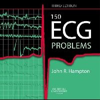 John Hampton 150 ECG Problems 