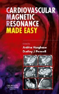 Anitha Varghese Cardiovascular Magnetic Resonance Made Easy ( - ) 