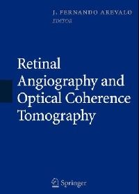 J. Fernando Arevalo (Ed.) Retinal Angiography and Optical Coherence Tomography (   ) 