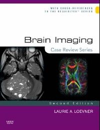 Loevner, Laurie A. Brain imaging 