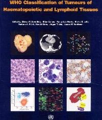 S.H Swerdlow WHO Classification of Tumours of Haematopoietic and Lymphoid Tissues 