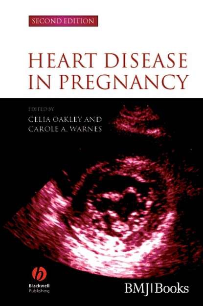 M, Oakley Celia, Shankar A.G. A G, Warnes A Carole Heart Disease in Pregnancy 