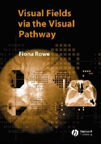 Rowe Fiona, Brainin Michael, Gilhus Nils Erik Visual Fields via the Visual Pathway 