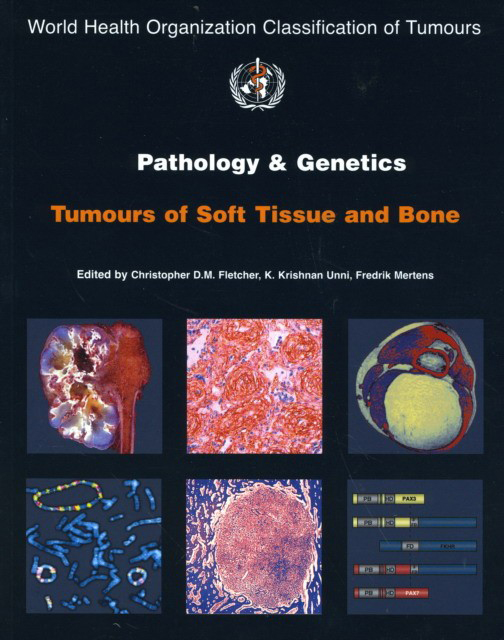 WHO Classification of Tumours Pathology & Genetics of Tumours of the Soft Tissue & Bone 