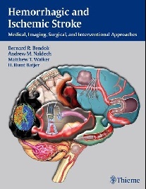 Bendok et al Hemorrhagic and ischemic stroke 