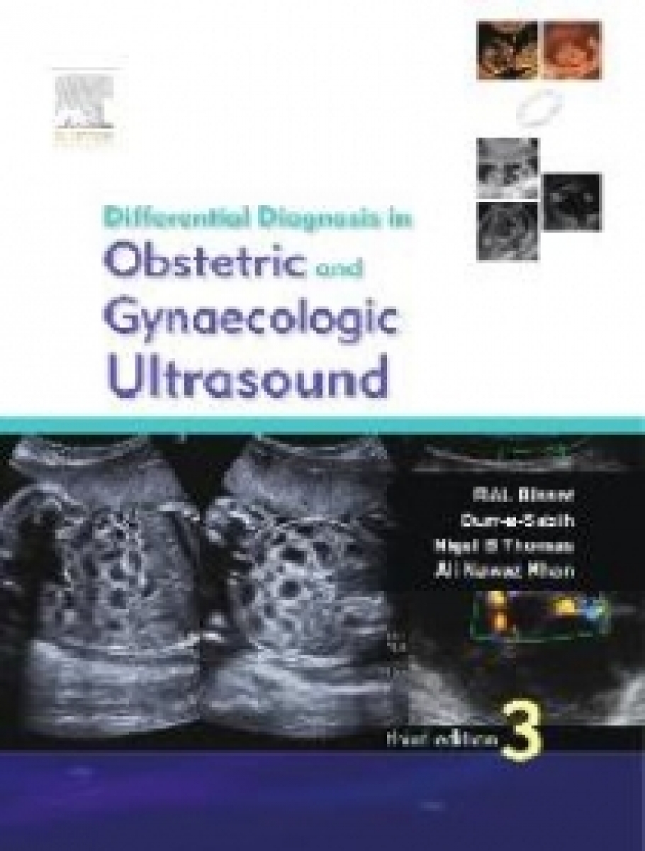 R A L Bisset Differential Diagnosis in Obstetrics and Gynecologic Ultrasound 