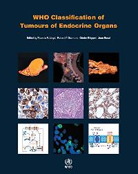 Lloyd RV, Osamura RY, Kloppel G, Rosai J WHO Classification of Tumours of Endocrine Organs, 4 Ed. 