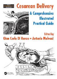 Gian Carlo Di Renzo, Antonio Malvasi Cesarean Delivery: A Comprehensive Illustrated Practical Guide 