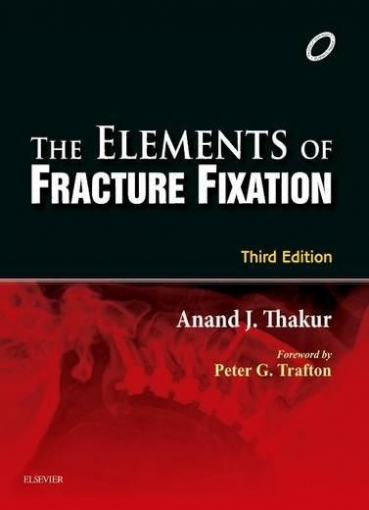 Thakur The Elements of Fracture Fixation, 3e 