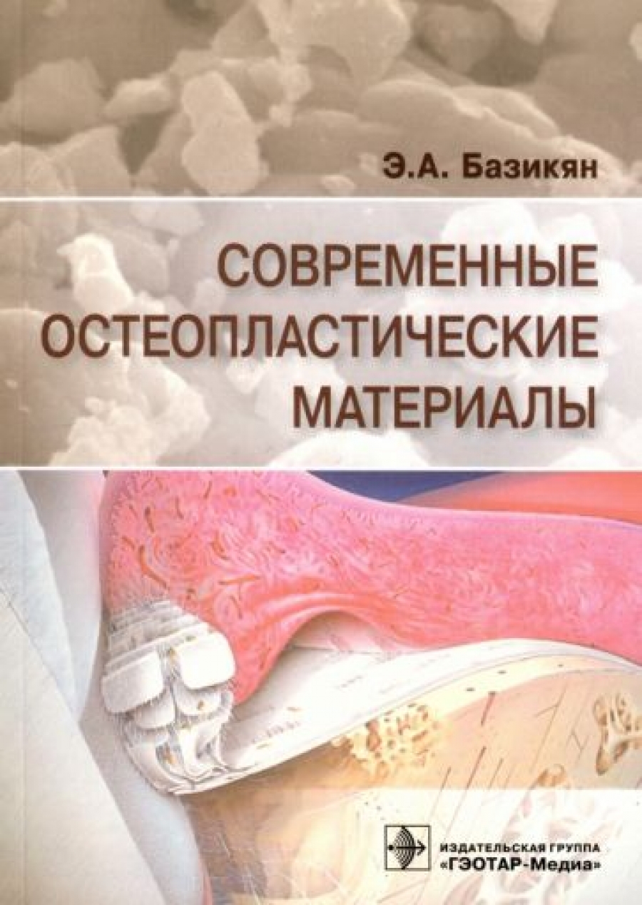 Базикян Э.А. Современные остеопластические материалы 