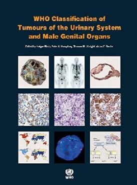 , H., Moch WHO Classification of Tumours of the Urinary System and Male Genital Organs.4 ed. 