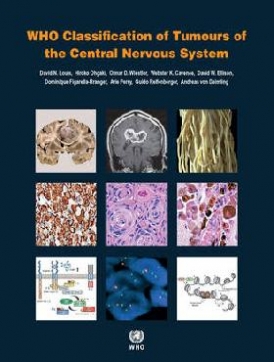 , Louis, D.N. WHO Classification of Tumours of the Central Nervous System, Revised. Fourth Edition 