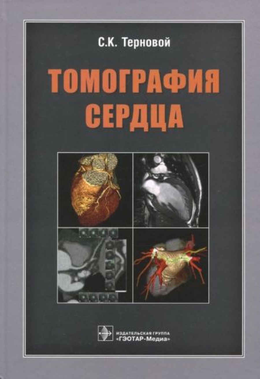 Терновой С.К. Томография сердца 