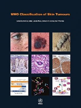 Elder D. E., Massi D., Scolyer R. WHO Classification of Skin Tumours. 4 ed. 
