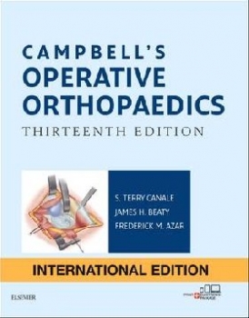 Azar Campbell's Operative Orthopaedics. 13 ed. IE, 4vols set 