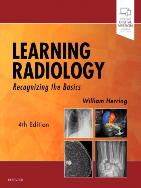 William, Herring Learning Radiology: Recognizing the Basics . 4 ed 