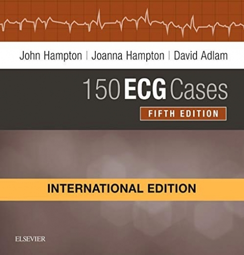 Hampton John R. 150 ECG Cases, International Edition. 