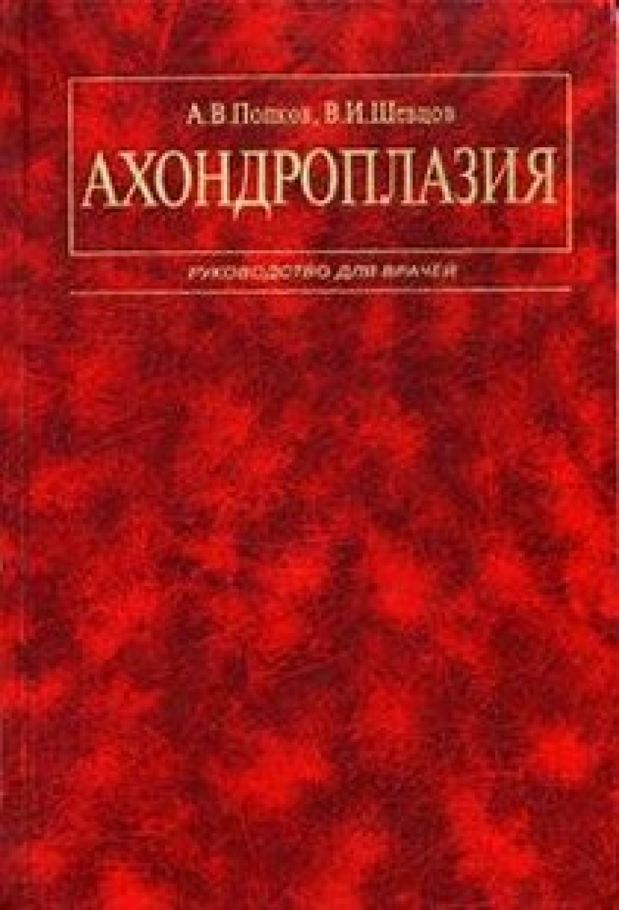 Шевцов В.И., Попков А.В. Ахондроплазия 