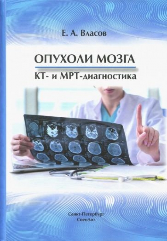 Власов Е.А. Опухоли мозга, КТ и МРТ диагностика 