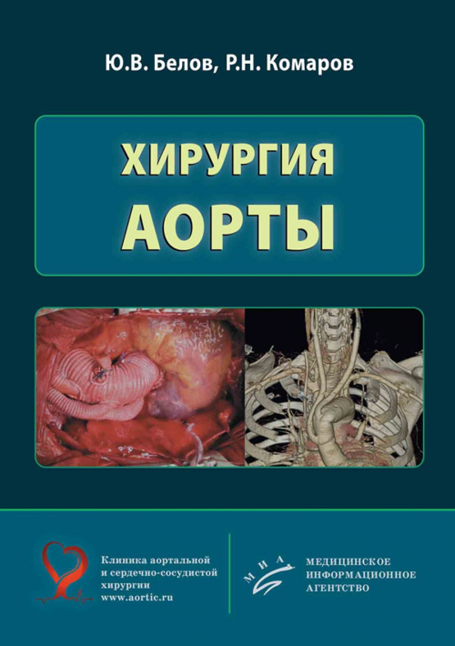 Белов Ю.В., Комаров Р.Н. Хирургия аорты 