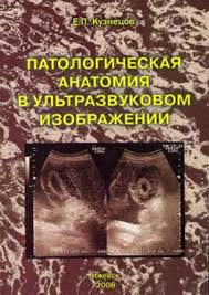 Кузнецов е п патологическая анатомия в ультразвуковом изображении