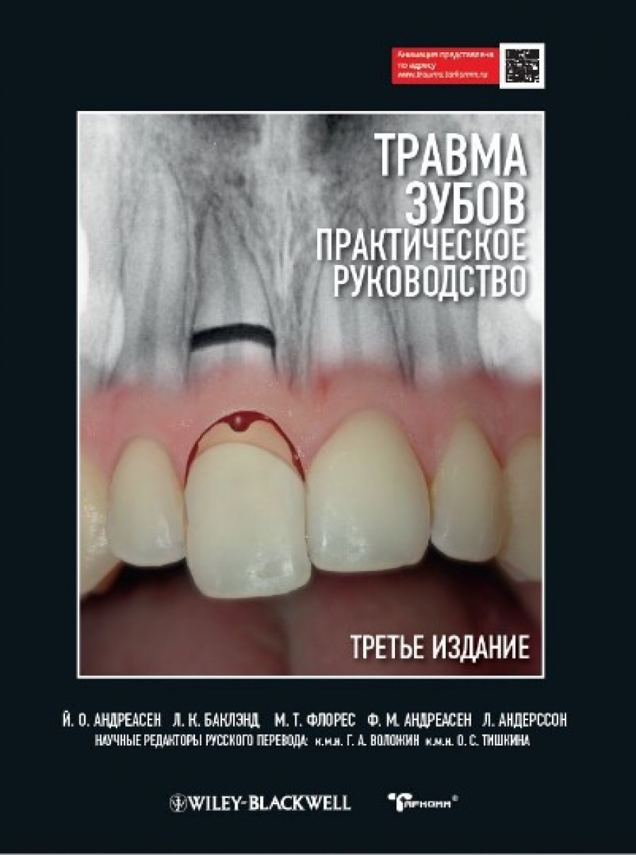Йенс О. Андреасен Травма зубов. Практическое руководство 