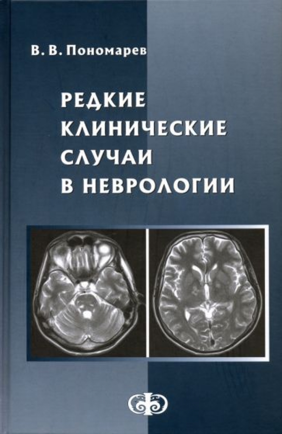 Пономарев В.В. Редкие клинические случаи в неврологии. Руководство для врачей 