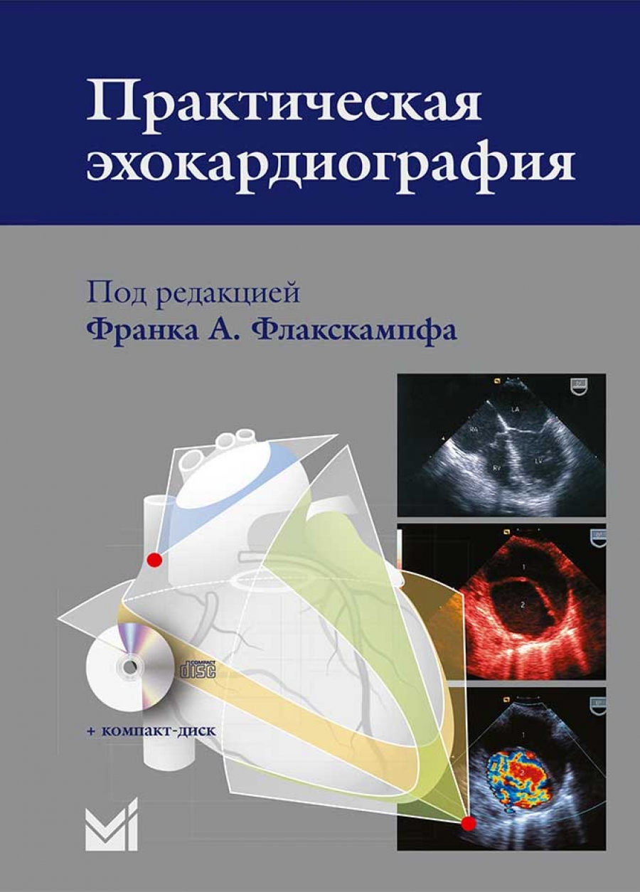 Эхокардиография Цена