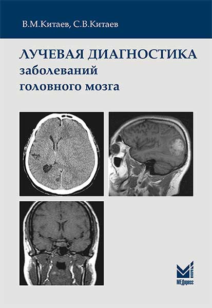 Китаев В.М., С.В.Китаев Лучевая диагностика заболеваний головного мозга 