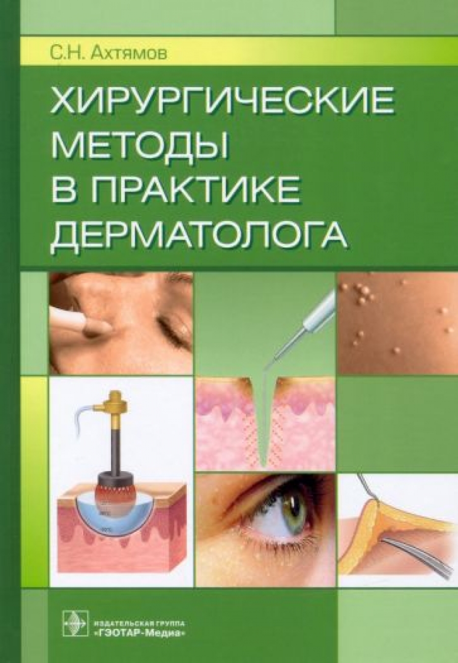 Ахтямов С.Н. Хирургические методы в практике дерматолога 