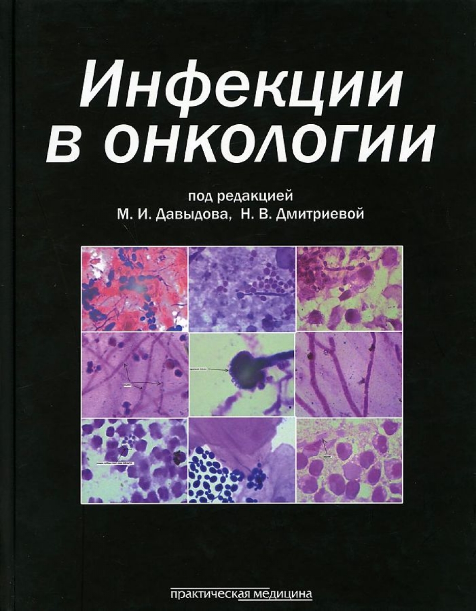 Давыдов М.И. Инфекции в онкологии 
