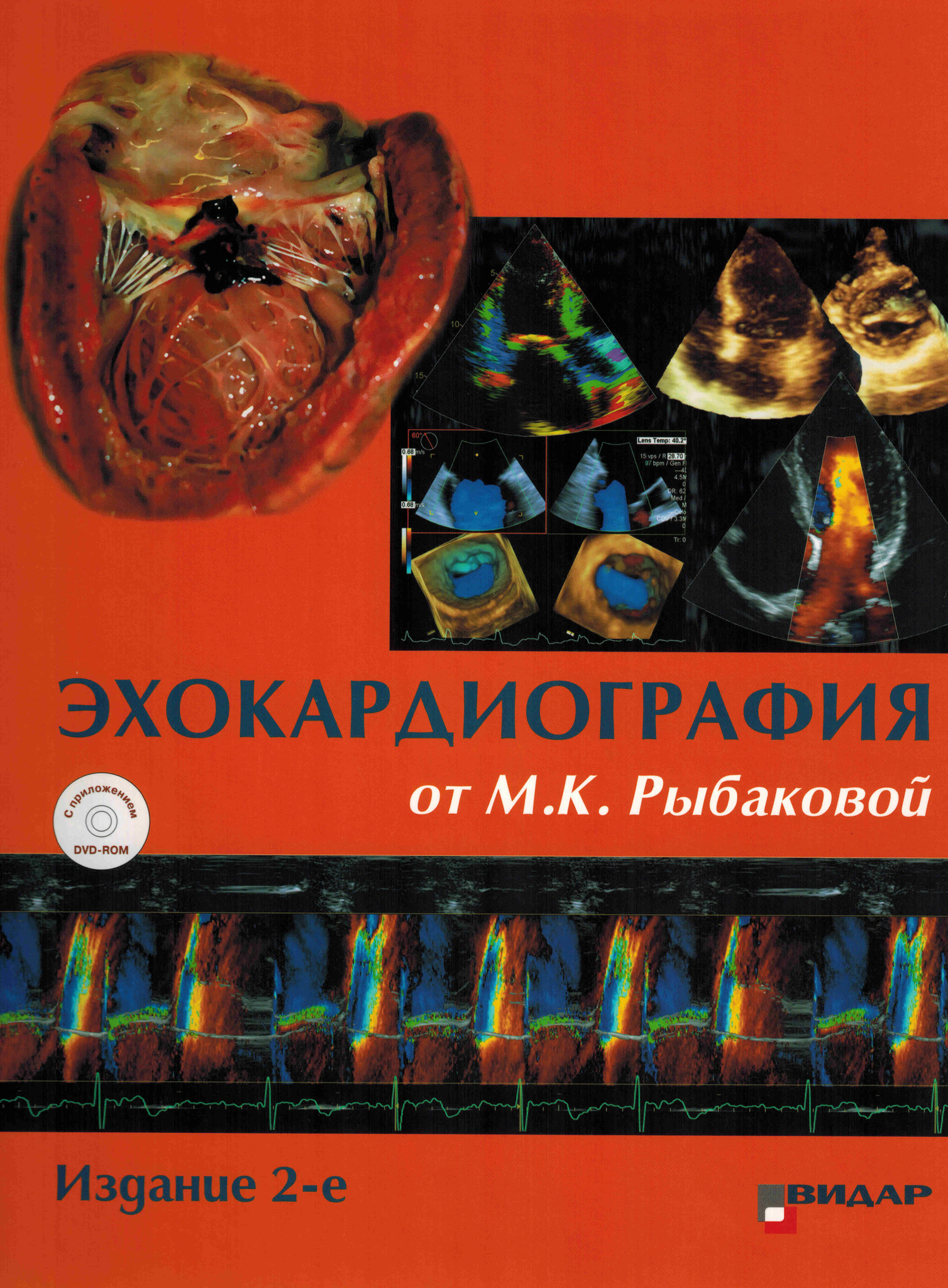 Эхокардиография Цена