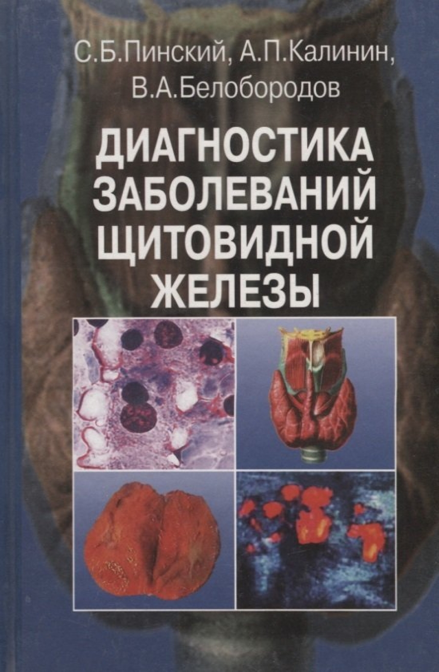 Белобородов В.А., Калинин А.П., Пинский С.Б. Диагностика заболеваний щитовидной железы 