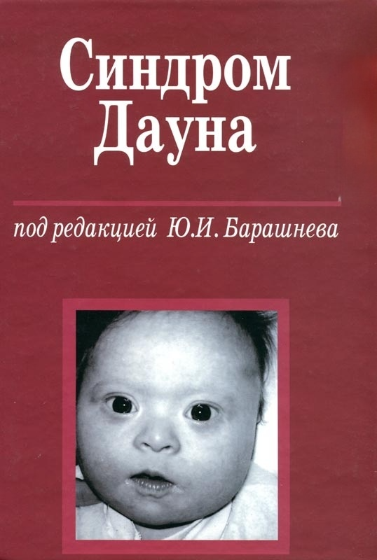 Синдром Дауна. Синдром Дауна книги. Пособие для даунов. Книжка для даунов. Синдром дауна в россии