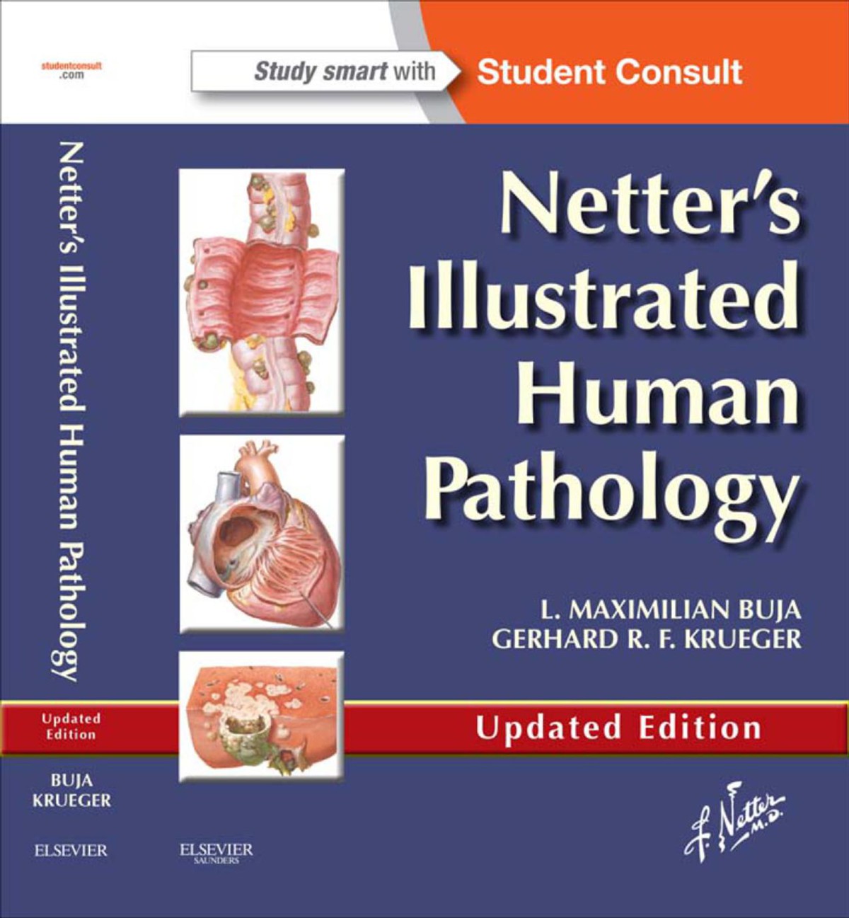 Buj L. Maximilian Netter's Illustrated Human Pathology Updated Edition, 