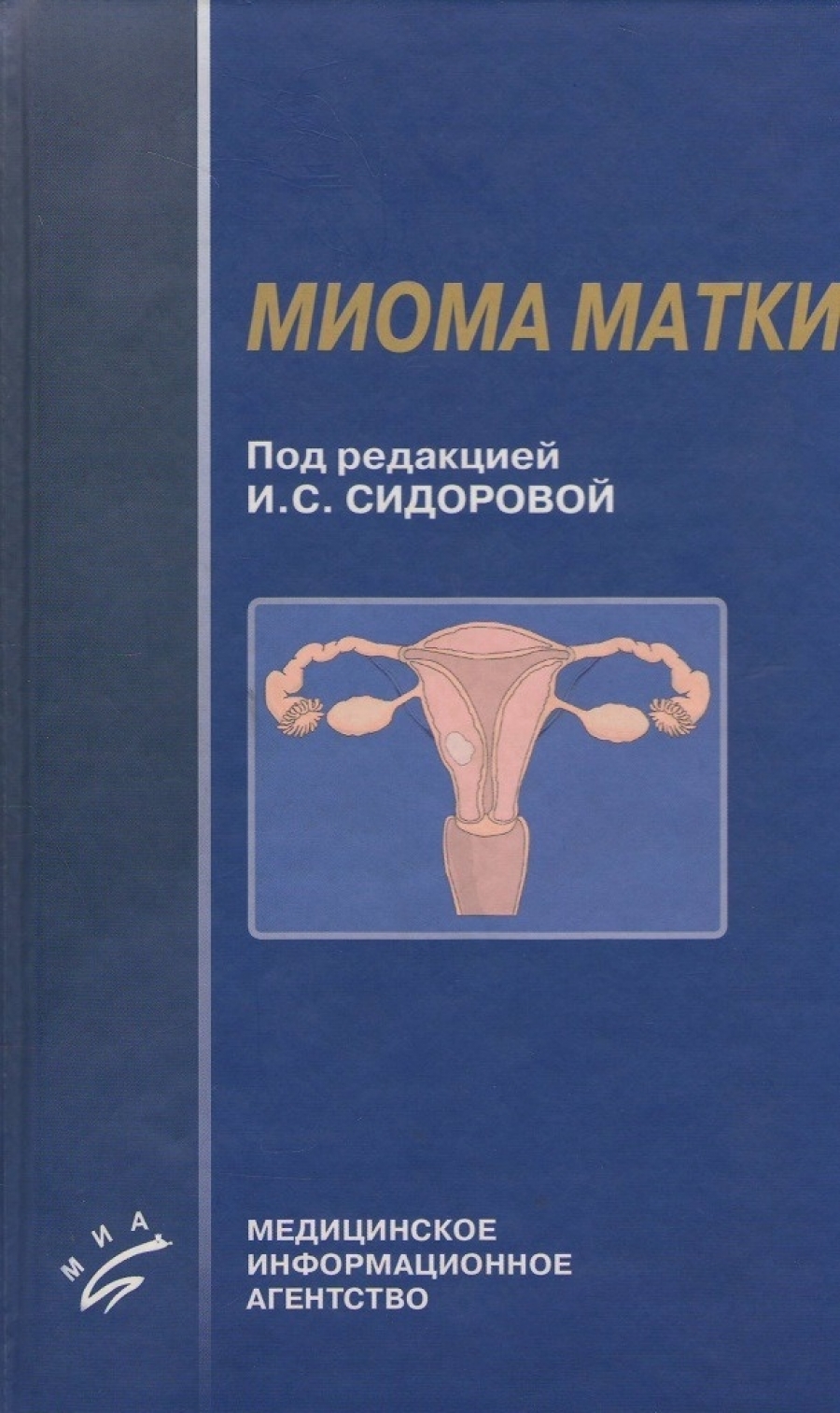 Миома матки психосоматика причины. Учебное пособие по миоме матки. Миома матки книги. Акушерство и гинекология миома матки. Миома матки психосоматика.