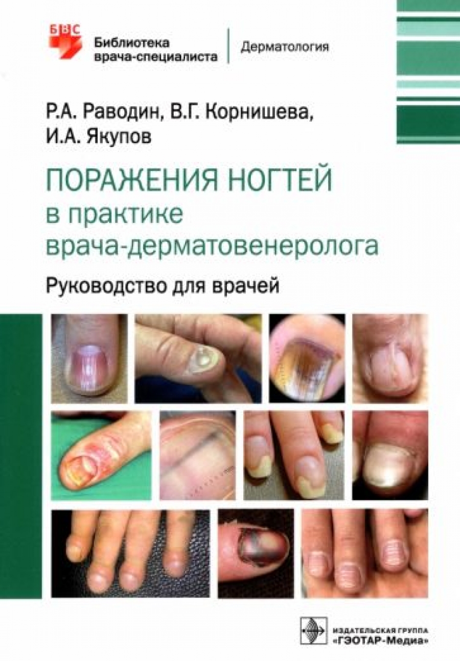 Корнишева В.Г., Раводин Р.А., Якупов И.А. Поражения ногтей в практике врача-дерматовенеролога : руководство для врачей 
