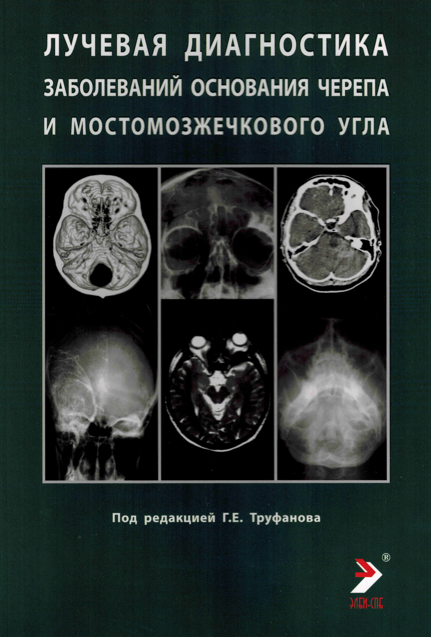 Труфанов Г.Е. Лучевая диагностика заболеваний оснований черепа и мостмозжечкового угла 