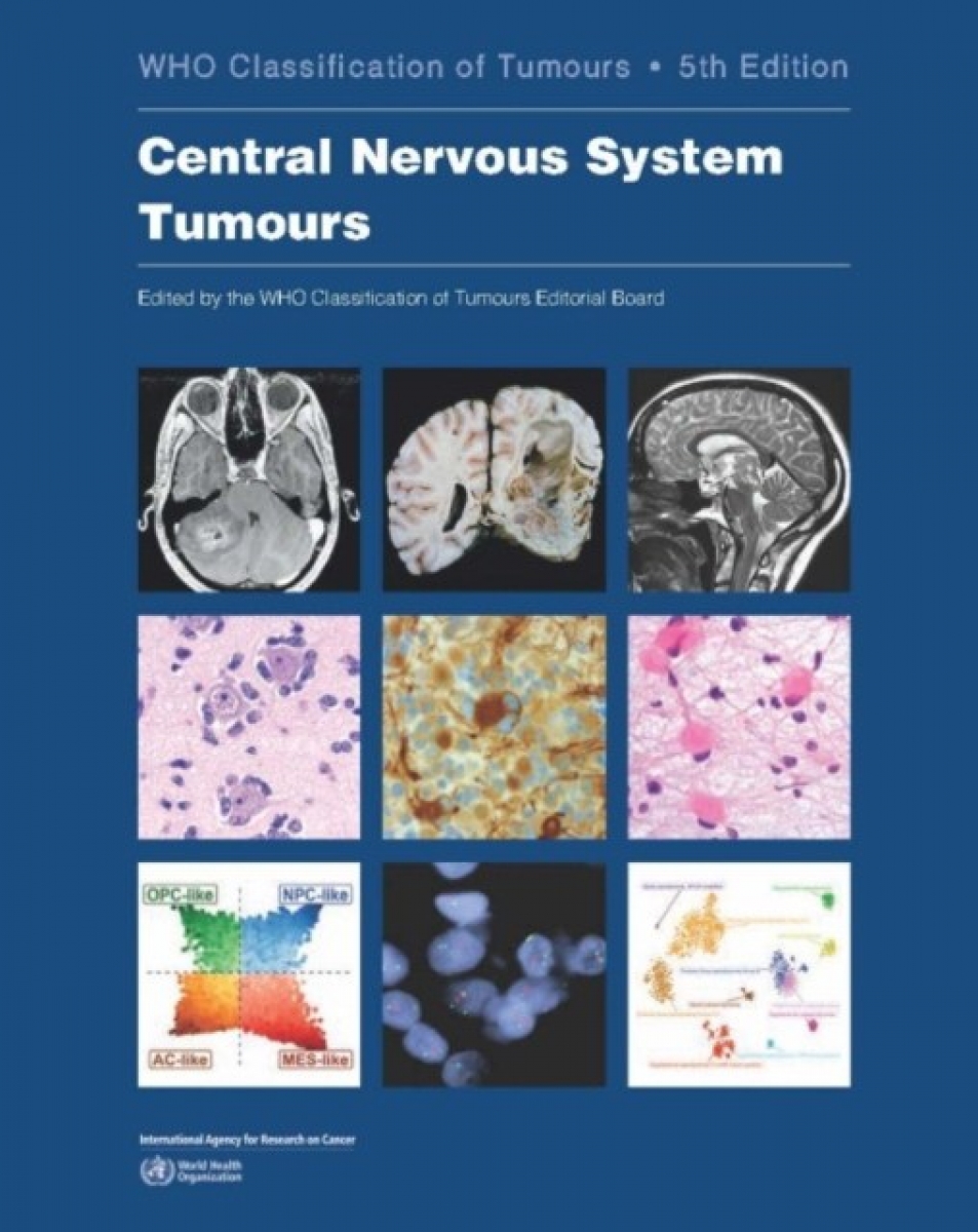 Who Classification of Tumours: Central Nervous System Tumours. 5 ed 