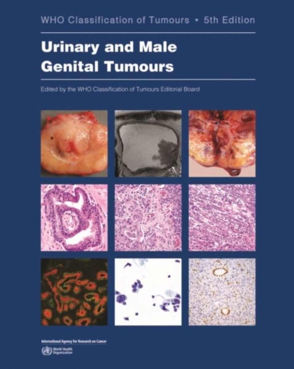 Who Classification of Tumour: Urinary and Male Genital Tumours 8 Vol. 